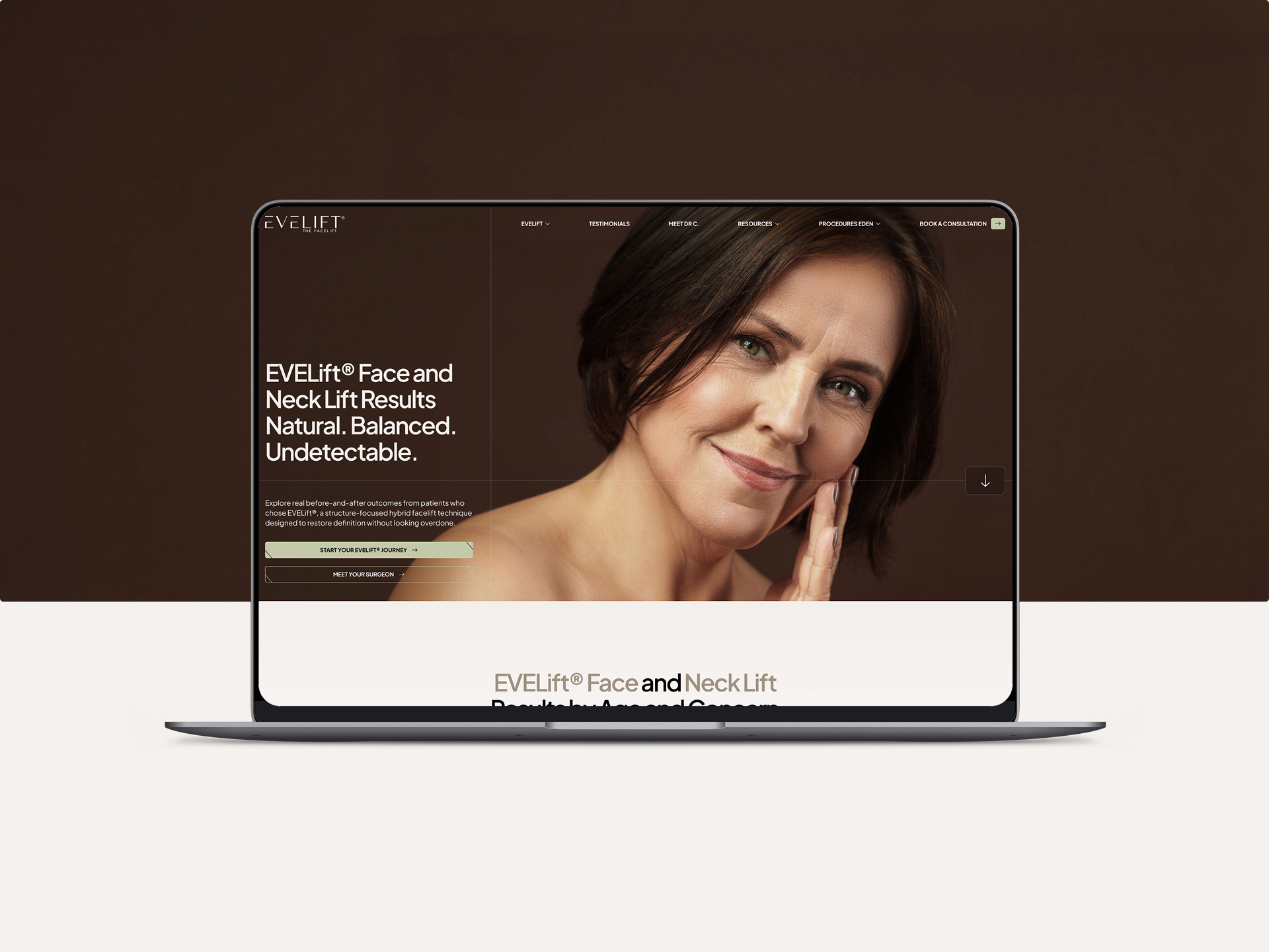 Evelift project gallery image, web design and branding by CR38